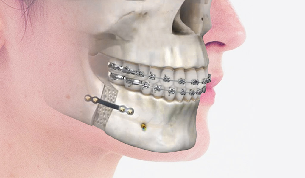 casos difíciles dentales en Mataró